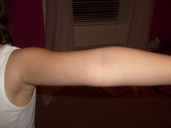Extended Elbow